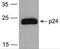 HIV-1 Gag polyprotein antibody, PM-6585-biotin, ProSci, Western Blot image 