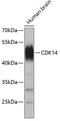 Cyclin Dependent Kinase 14 antibody, 19-033, ProSci, Western Blot image 