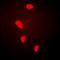 Four And A Half LIM Domains 1 antibody, orb340919, Biorbyt, Immunofluorescence image 