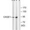 Cancer Antigen 1 antibody, PA5-49998, Invitrogen Antibodies, Western Blot image 