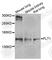 Fms Related Tyrosine Kinase 1 antibody, A1277, ABclonal Technology, Western Blot image 