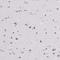 Zinc Finger Protein 860 antibody, HPA063386, Atlas Antibodies, Immunohistochemistry paraffin image 
