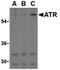 ATR Serine/Threonine Kinase antibody, orb74495, Biorbyt, Western Blot image 