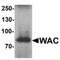 WW Domain Containing Adaptor With Coiled-Coil antibody, MBS153531, MyBioSource, Western Blot image 