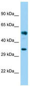 Family With Sequence Similarity 49 Member B antibody, TA331905, Origene, Western Blot image 