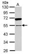 Sperm Associated Antigen 8 antibody, NBP2-20464, Novus Biologicals, Western Blot image 