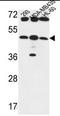 UDP-GlcNAc:betaGal beta-1,3-N-acetylglucosaminyltransferase 5 antibody, AP50329PU-N, Origene, Western Blot image 