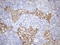 Protein CIP2A antibody, LS-C794375, Lifespan Biosciences, Immunohistochemistry paraffin image 