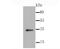 DNA-binding protein inhibitor ID-1 antibody, A00945-1, Boster Biological Technology, Western Blot image 