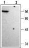 Potassium voltage-gated channel subfamily A member 4 antibody, TA328927, Origene, Western Blot image 