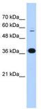Prolyl 4-Hydroxylase Subunit Beta antibody, TA346538, Origene, Western Blot image 