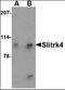 SLIT And NTRK Like Family Member 4 antibody, orb88749, Biorbyt, Western Blot image 