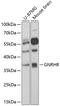 Gonadotropin Releasing Hormone Receptor antibody, 15-567, ProSci, Western Blot image 