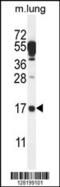 D-Aminoacyl-TRNA Deacylase 2 antibody, 55-258, ProSci, Western Blot image 
