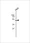 Presenilin 2 antibody, 61-056, ProSci, Western Blot image 