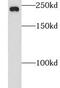 CCR4-NOT Transcription Complex Subunit 1 antibody, FNab01805, FineTest, Western Blot image 