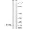 Mitochondrial Ribosomal Protein S25 antibody, A14080, Boster Biological Technology, Western Blot image 