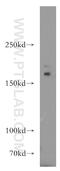 AC-III antibody, 19492-1-AP, Proteintech Group, Western Blot image 