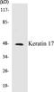 Keratin 17 antibody, EKC1323, Boster Biological Technology, Western Blot image 