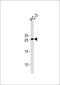 Homeobox C6 antibody, PA5-25156, Invitrogen Antibodies, Western Blot image 