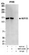 Nucleoporin 155 antibody, NBP2-22286, Novus Biologicals, Immunoprecipitation image 