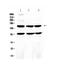 FLT4 antibody, A01276-2, Boster Biological Technology, Western Blot image 