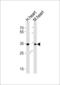Ankyrin Repeat And SOCS Box Containing 11 antibody, LS-C203802, Lifespan Biosciences, Western Blot image 