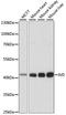Isovaleryl-CoA Dehydrogenase antibody, A01404, Boster Biological Technology, Western Blot image 
