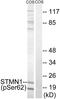 OP18 antibody, AP55746PU-S, Origene, Western Blot image 