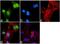 FTO Alpha-Ketoglutarate Dependent Dioxygenase antibody, PA1-1045, Invitrogen Antibodies, Immunofluorescence image 