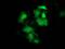 Heat Shock Protein Family B (Small) Member 8 antibody, MA5-25112, Invitrogen Antibodies, Immunocytochemistry image 