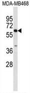 Carboxylesterase 5A antibody, AP50870PU-N, Origene, Western Blot image 