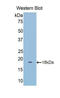 Galectin 9B antibody, LS-C297176, Lifespan Biosciences, Western Blot image 
