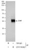 CXADR Ig-Like Cell Adhesion Molecule antibody, GTX118382, GeneTex, Immunoprecipitation image 