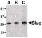 Snail Family Transcriptional Repressor 2 antibody, PA5-20290, Invitrogen Antibodies, Western Blot image 