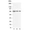 Cell Division Cycle 25B antibody, R30622, NSJ Bioreagents, Western Blot image 