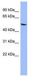 Cytochrome P450 Family 2 Subfamily D Member 6 antibody, TA346158, Origene, Western Blot image 