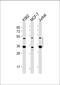 Methyl-CpG-binding domain protein 2 antibody, M01746-1, Boster Biological Technology, Western Blot image 