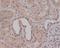 Mothers against decapentaplegic homolog 1 antibody, M00728-1, Boster Biological Technology, Immunohistochemistry paraffin image 