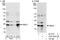 Ubiquitin Conjugating Enzyme E2 T antibody, A301-874A, Bethyl Labs, Immunoprecipitation image 