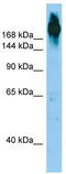 Filamin C antibody, TA338310, Origene, Western Blot image 
