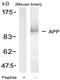 Amyloid Beta Precursor Protein antibody, AP02715PU-N, Origene, Western Blot image 