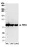 Threonyl-TRNA Synthetase antibody, A304-755A, Bethyl Labs, Western Blot image 