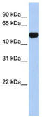 Potassium Voltage-Gated Channel Subfamily J Member 12 antibody, TA338595, Origene, Western Blot image 