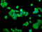 Regulatory Factor X Associated Ankyrin Containing Protein antibody, CSB-PA019617LA01HU, Cusabio, Immunofluorescence image 