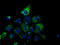 3-Hydroxyisobutyryl-CoA Hydrolase antibody, TA501318, Origene, Immunofluorescence image 
