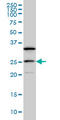 Dephospho-CoA Kinase Domain Containing antibody, LS-C105177, Lifespan Biosciences, Western Blot image 