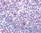 Nucleolin antibody, PA3-16875, Invitrogen Antibodies, Immunohistochemistry paraffin image 