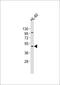 Carbohydrate Sulfotransferase 12 antibody, A10456-1, Boster Biological Technology, Western Blot image 