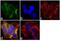 Neurofibromin 1 antibody, MA1-084, Invitrogen Antibodies, Immunofluorescence image 